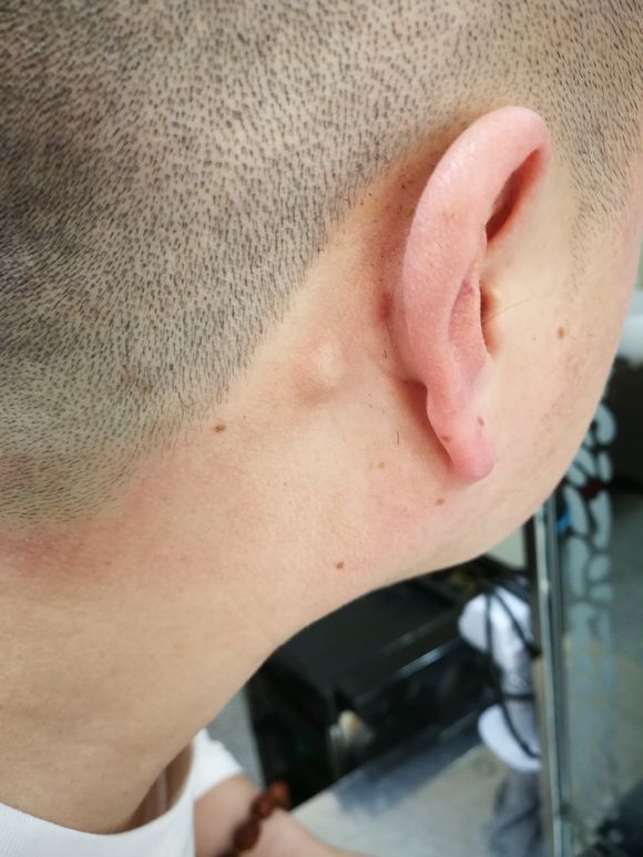 求告知急！！！