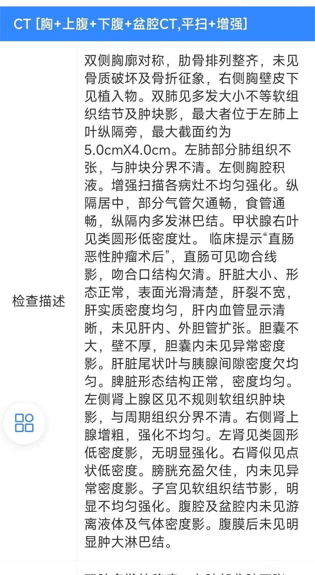 没出来片子能看看吗