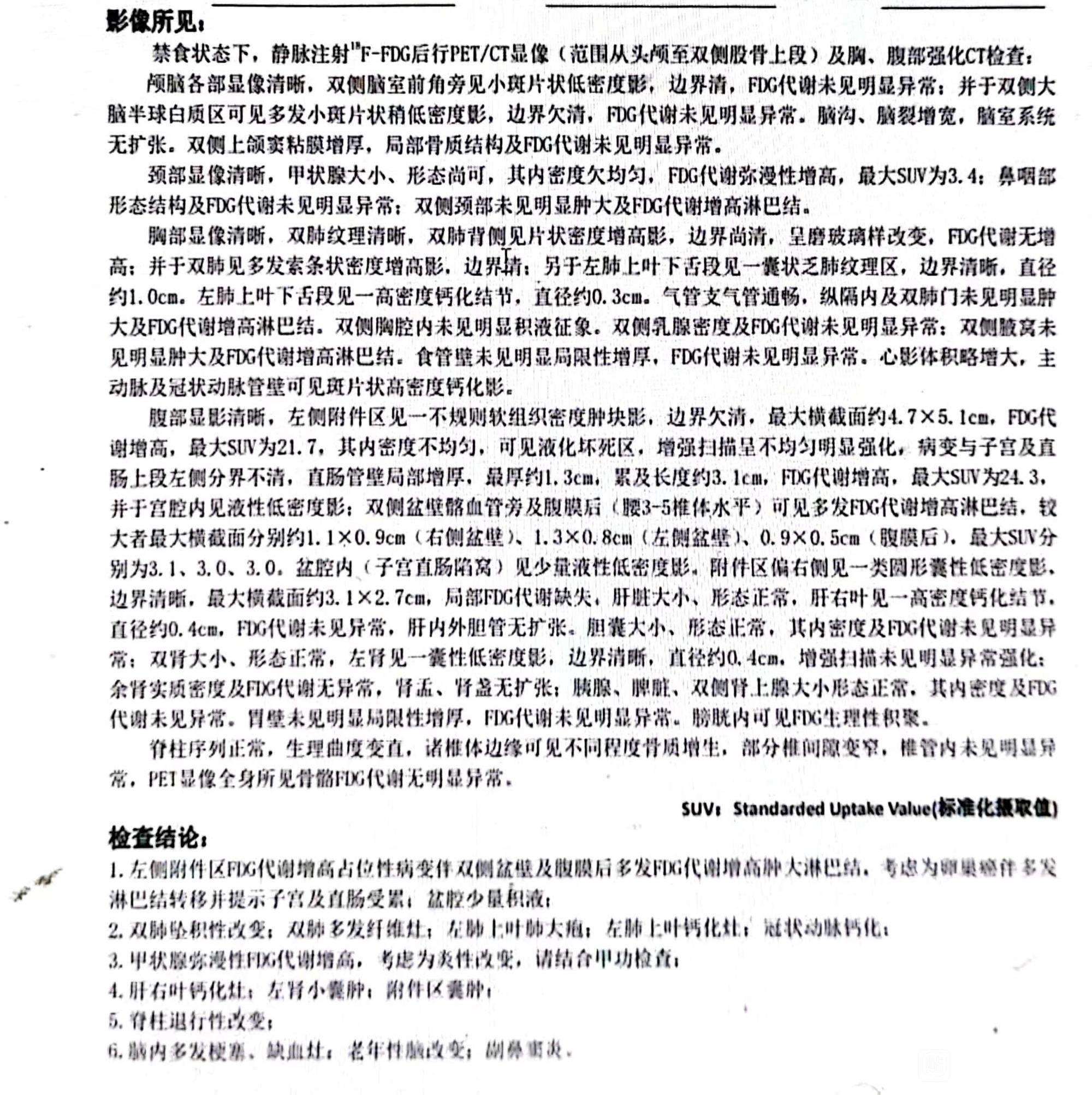 看看这个转移了吗